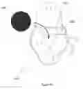 Fig. 15 - Article for receiving a body of an animal