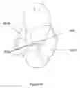 Fig. 17 - Article for receiving a body of an animal