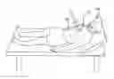 Fig. 01 - Device for elevating the head and chest for treating low blood flow states