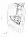 Fig. 09 - Device for elevating the head and chest for treating low blood flow states