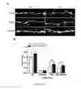 Fig. 30 - Modulators of Sestrin-GATOR2 interaction and uses thereof