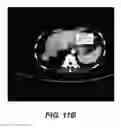 Fig. 13 - Methods for treating cancer