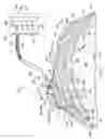 Fig. 02 - Customizable closed tissue site dressing for improved postoperative removal