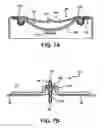 Fig. 06 - Nighttime basal dosing device