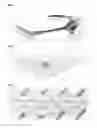 Fig. 06 - External trigeminal nerve stimulation for the acute non-invasive treatment of migraine attacks
