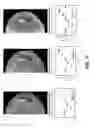 Fig. 35 - Monochromatic X-ray imaging systems and methods