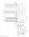 Fig. 09 - Water purification system with automatic flush flow