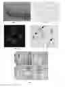 Fig. 02 - Antibodies to oxidized phospholipids