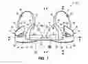 Fig. 02 - BREAST SAVER