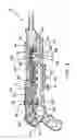 Fig. 04 - Compact improved bug killing gun