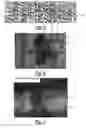 Fig. 04 - Method of measuring localized strains in sheet metal stampings
