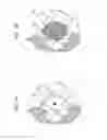 Fig. 02 - Method for performing a blood count and determining the morphology of a blood smear