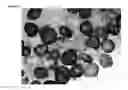 Fig. 06 - METHODS OF DIAGNOSING DEFECTS IN A PROCESSING UNIT OR HYDRUALIC FRACTURING PROCESS BY ANALYZING SOLID PARTICLES FROM THE PROCESSING UNIT OR HYDRUALIC FRACTURING PROCESS