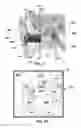 Fig. 04 - Ear-borne audio device conversation recording and compressed data transmission