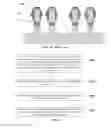 Fig. 04 - Channel stop imp for FinFET device
