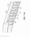 Fig. 100 - Protective encasement for a mobile computing device