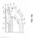 Fig. 111 - Protective encasement for a mobile computing device