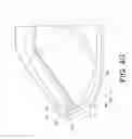 Fig. 18 - Protective encasement for a mobile computing device