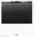 Fig. 08 - ULTRADWARF BERMUDAGRASS CALLED 