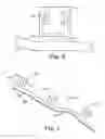 Fig. 03 - Orthodontic appliance including arch member