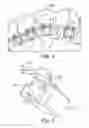 Fig. 05 - Orthodontic appliance including arch member