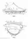 Fig. 02 - Midsole system with graded response