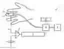 Fig. 01 - METHOD FOR CORRECTING CUFF PRESSURE IN A NON-INVASIVE BLOOD PRESSURE MEASUREMENT