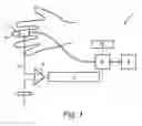 Fig. 02 - METHOD FOR CORRECTING CUFF PRESSURE IN A NON-INVASIVE BLOOD PRESSURE MEASUREMENT