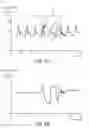 Fig. 08 - METHOD FOR CORRECTING CUFF PRESSURE IN A NON-INVASIVE BLOOD PRESSURE MEASUREMENT
