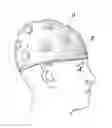 Fig. 01 - Electrode assemblies and electroencephalographic devices, methods and kits