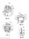 Fig. 12 - Electrode assemblies and electroencephalographic devices, methods and kits