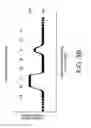 Fig. 05 - Devices, systems, and methods for determining vein geometric and compliance profiles for venous stenting