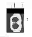 Fig. 41 - Lung screening assessment system