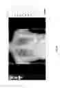 Fig. 44 - Lung screening assessment system