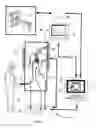 Fig. 02 - Bodily sealants and methods and apparatus for image-guided delivery of same