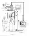 Fig. 08 - Bodily sealants and methods and apparatus for image-guided delivery of same