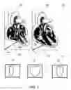 Fig. 09 - Bodily sealants and methods and apparatus for image-guided delivery of same