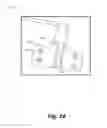 Fig. 04 - Retraction devices and methods of its use and manufacture