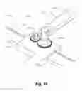 Fig. 15 - Retraction devices and methods of its use and manufacture