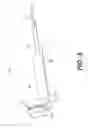 Fig. 06 - Bone anchor including only suture material and delivery device thereof