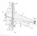 Fig. 08 - Bone anchor including only suture material and delivery device thereof