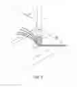 Fig. 06 - Knotless lateral row implant