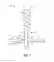 Fig. 08 - Knotless lateral row implant