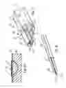 Fig. 07 - Suturing device for laparoscopic procedures
