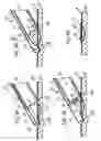 Fig. 08 - Suturing device for laparoscopic procedures