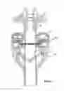 Fig. 05 - TROCAR