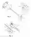 Fig. 09 - Systems and methods for introducing a bone anchor