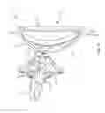 Fig. 07 - Spinal implant system and method