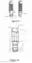 Fig. 06 - PROXIMAL INTERPHALANGEAL FUSION DEVICE