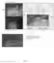 Fig. 05 - System and method for enhanced data analysis with video enabled software tools for medical environments